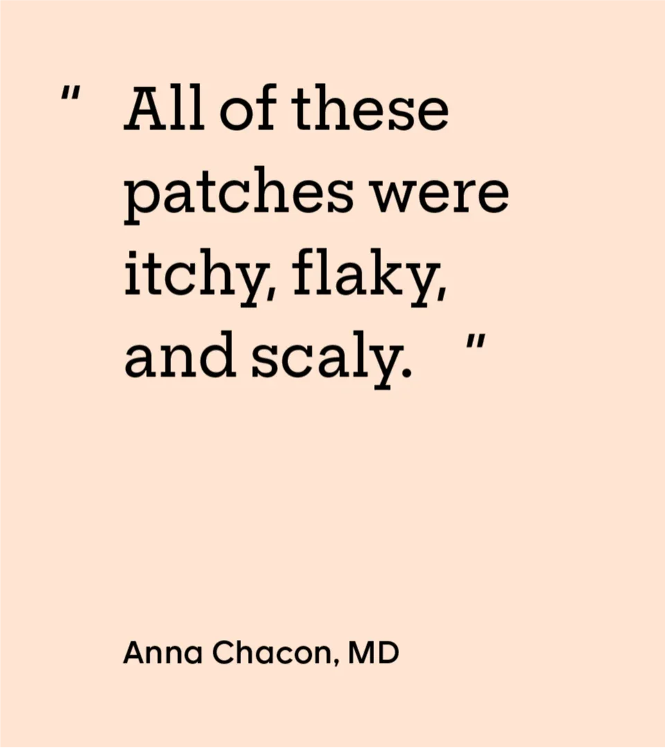 Psoriasis: medicine cabinet psoriasis quote 1