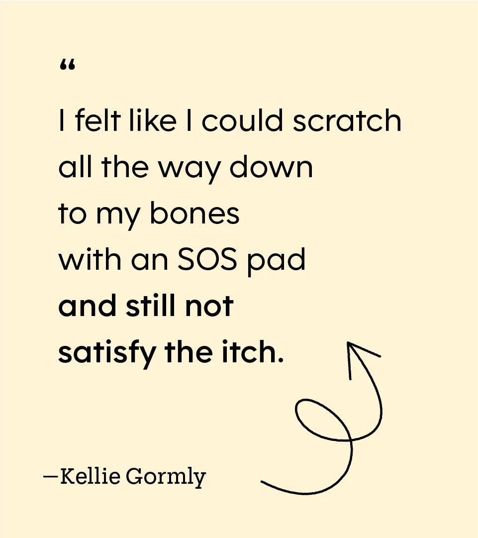 Health: Patient experiences: my journey eczema-01