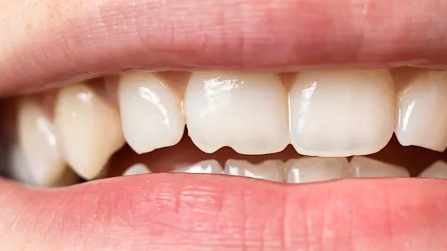 Health: Dental care: close up white teeth-1313472228