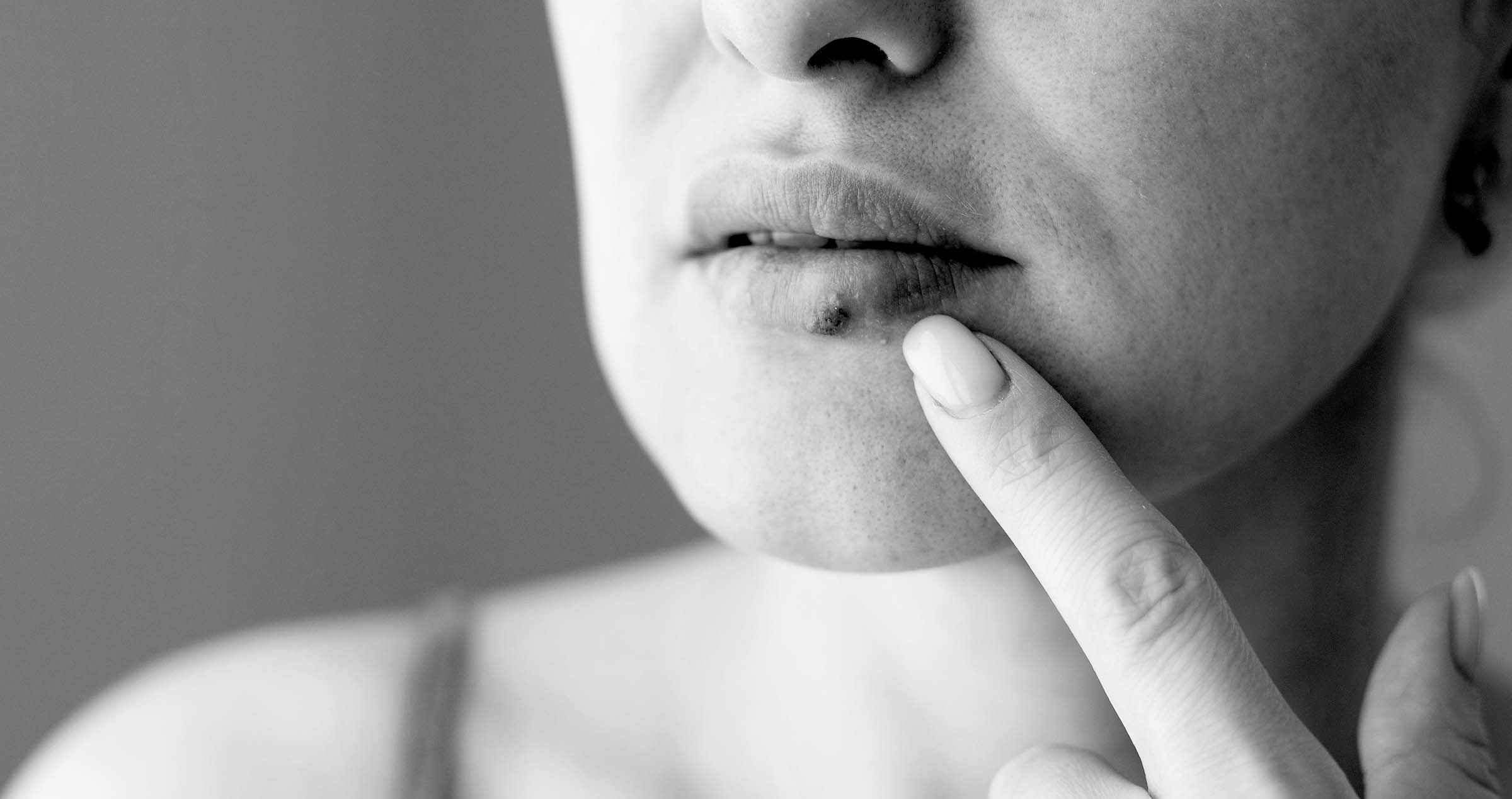 Why Does My Lips Turn Black And White