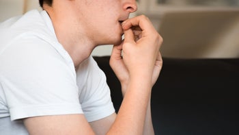Dermatology: closeup teen biting nails 1484950305