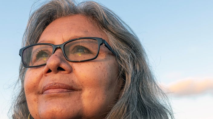 Portrait of woman with liver spots on her face