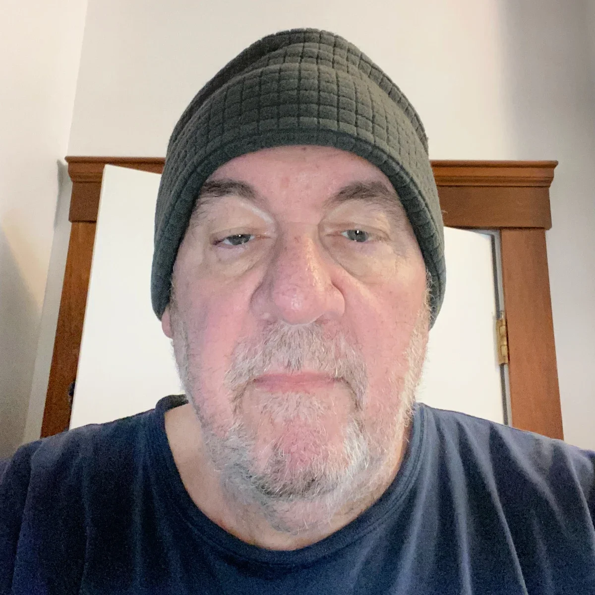 Bill Thompson is pictured wearing a knit cap while going through chemo treatment.