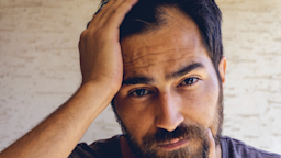 Supplement manufacturers claim biotin can help hair and nails grow stronger, but does it work? Review the research on biotin for hair and see for yourself.