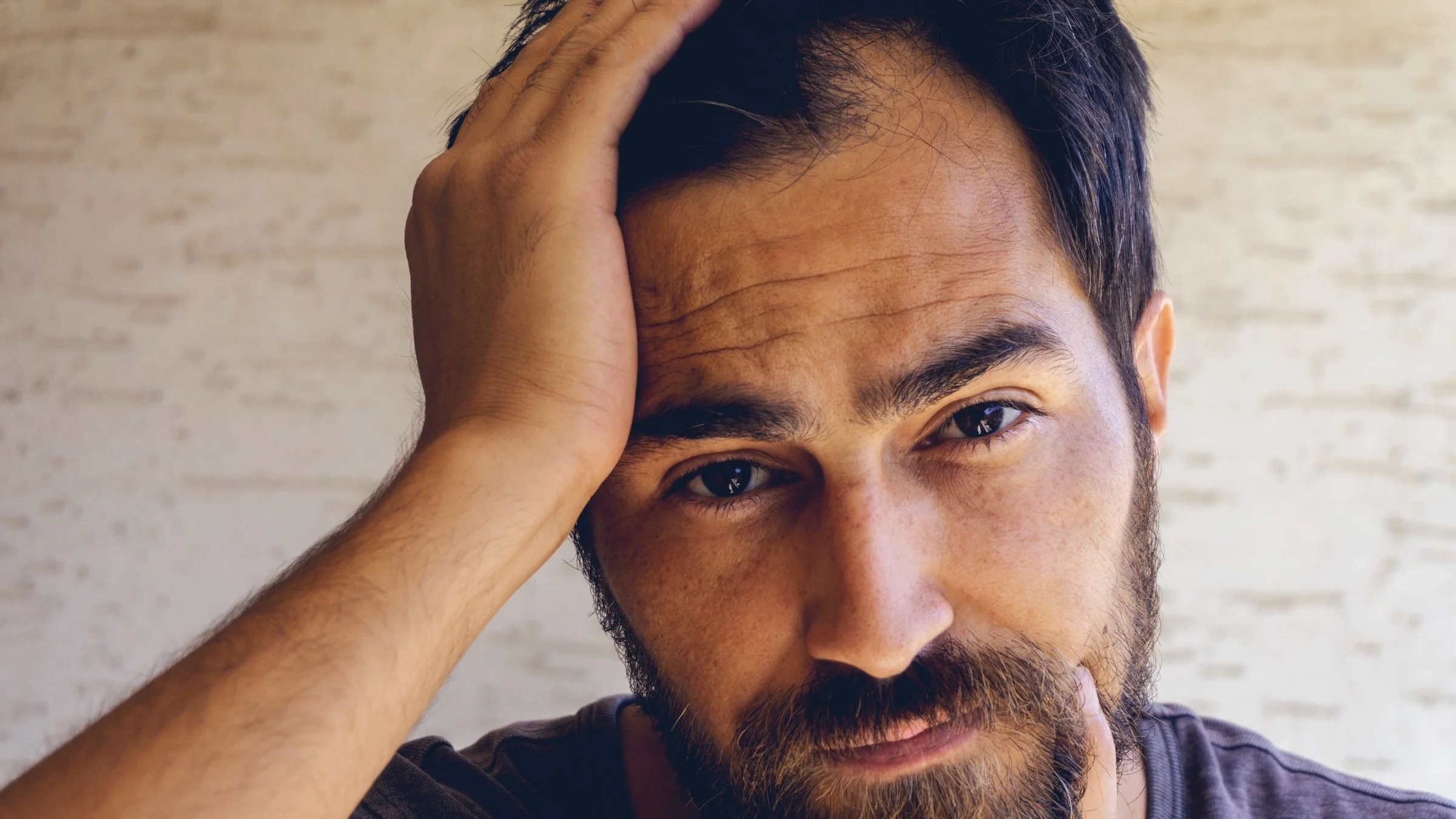 Portrait of a man pulling his hair to the side to show a balding spot with a neutral look on his face.