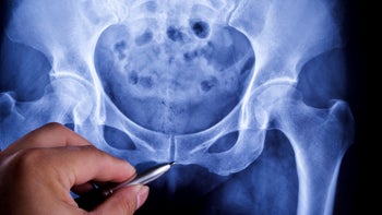 Parenthood Pregnancy: pubic region xray doctor point with pen-180750087