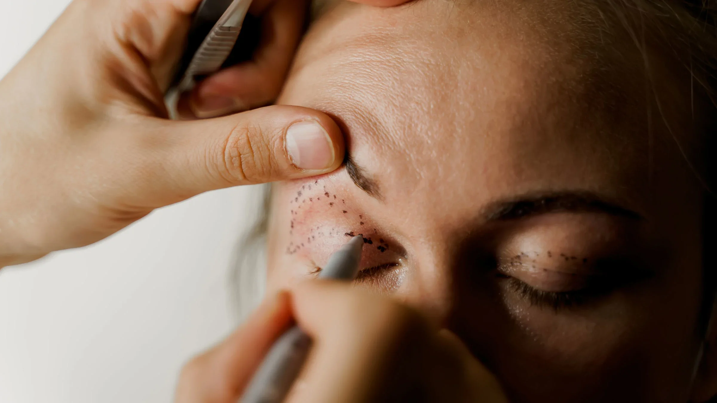 Close-up of eyelid surgery.
Rabizo/iStock via Getty Images Plus

