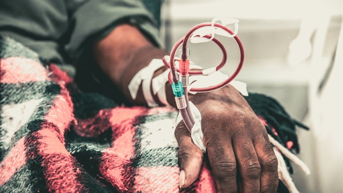 Close-up of dialysis.