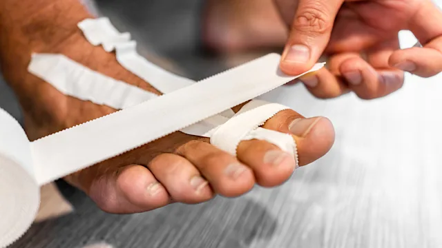 Musculoskeletal: Foot: closeup man taping broken toe 1384045437