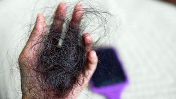 Hair loss: closeup woman hair loss 1351287220