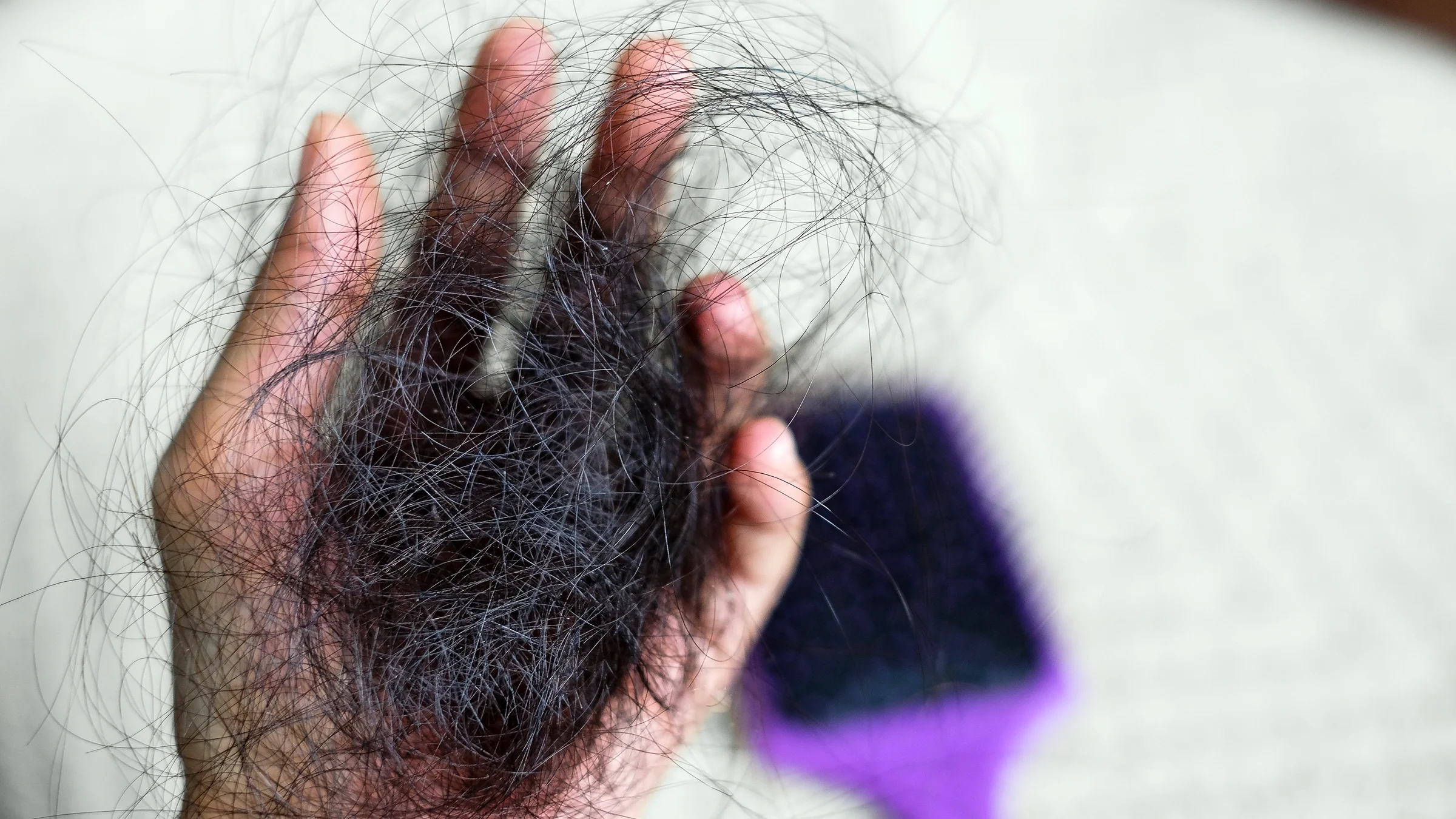 A woman holds a clump of hair. Losing hair after giving birth is normal. This is usually due to a change in estrogen levels.