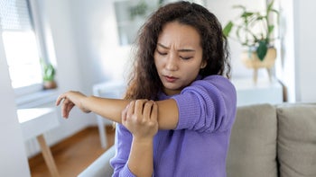 Dermatology: woman looking at her elbow 1456722387