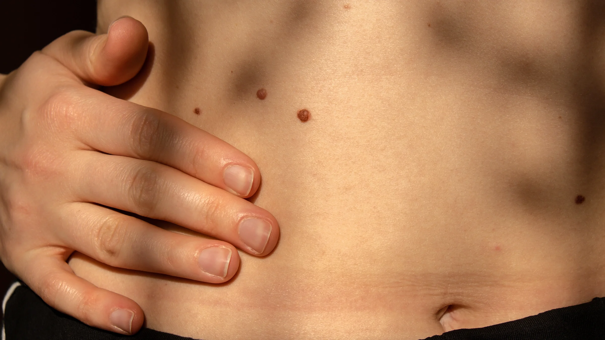 Close-up detail of the bare skin with birthmark and moles.