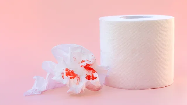 Anal fissure: toliet paper blood-1302569257