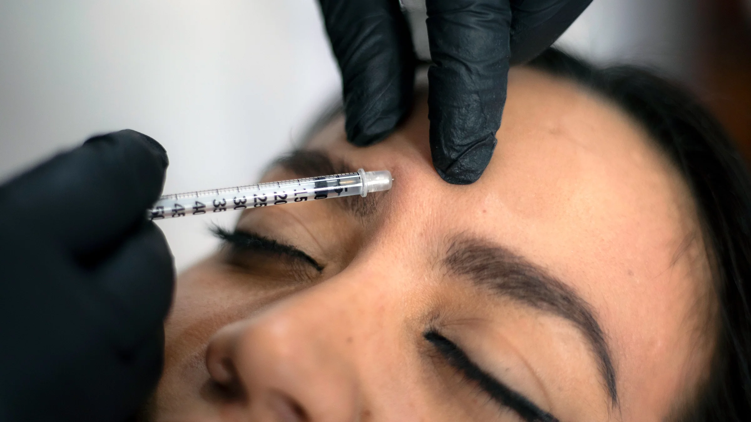 A woman is receiving Botox in a close-up.