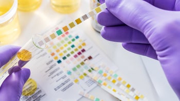 Urology: urine strip test 1074854026