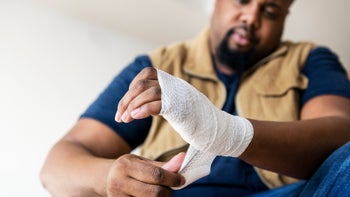Dermatology: Dermabond: man injured wrist wrapped-938931540