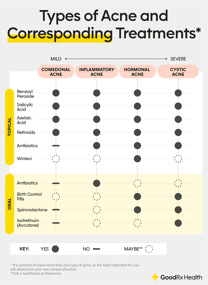 Infographic showing different types of acne and their corresponding treatments.