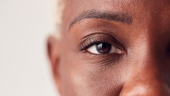 Side effects: Eye: closeup woman eye-1207244495