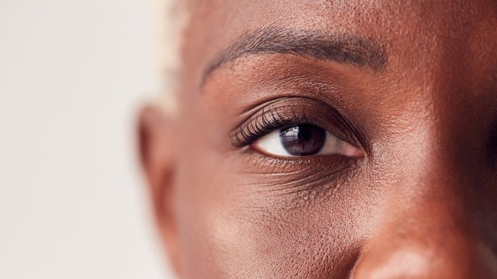Is Crossing Your Eyes Harmful?