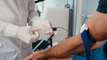 Colon-cancer: closeup drawing blood 1420662949