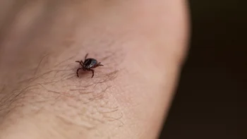 Lyme disease: closeup tick on hand 173900331