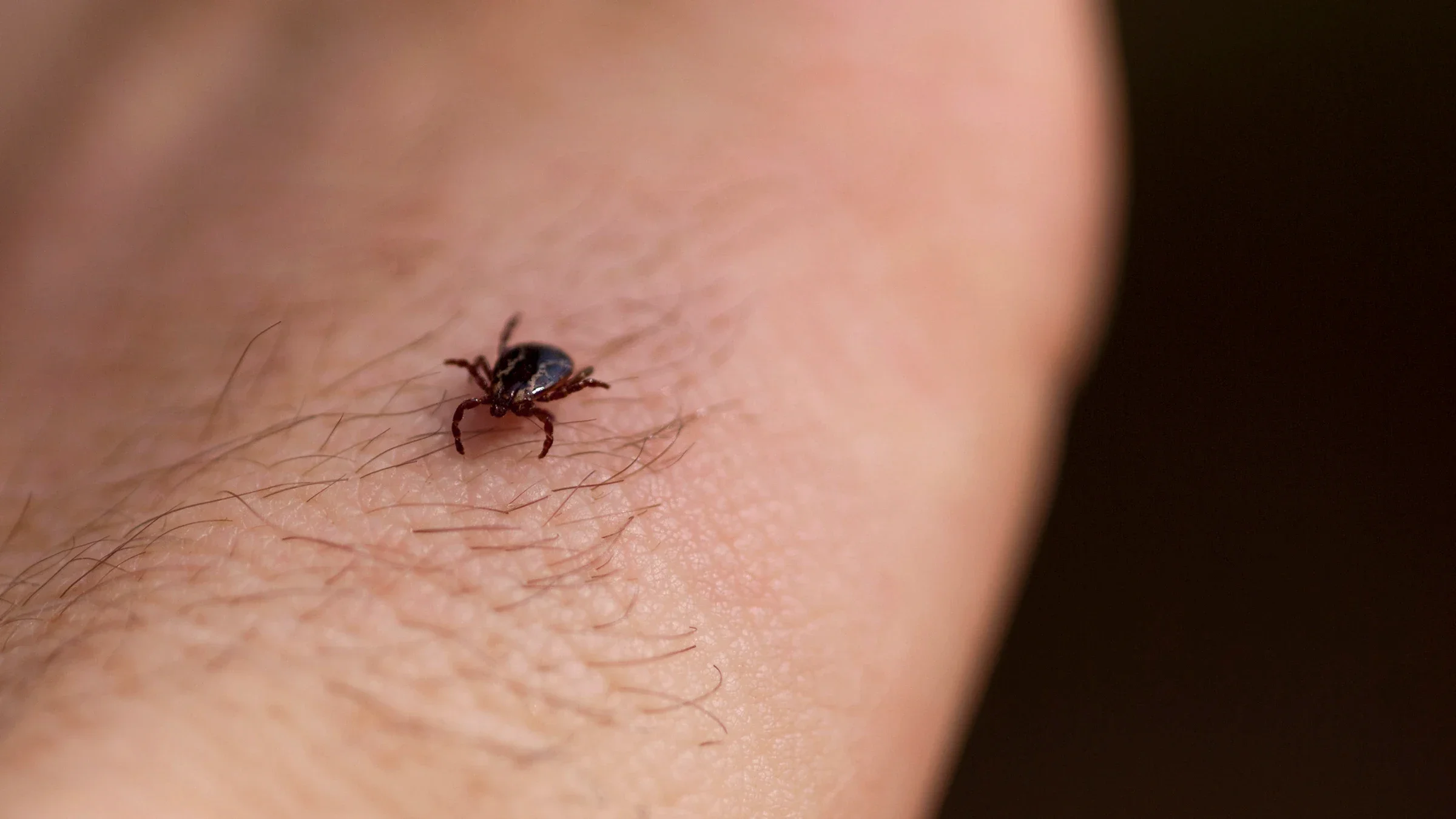 Close-up tick on the back of a hand.
ArtBoyMB/iStock via Getty Images Plus