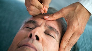 Health: Sleep apnea: closeup man acupuncture 636209348