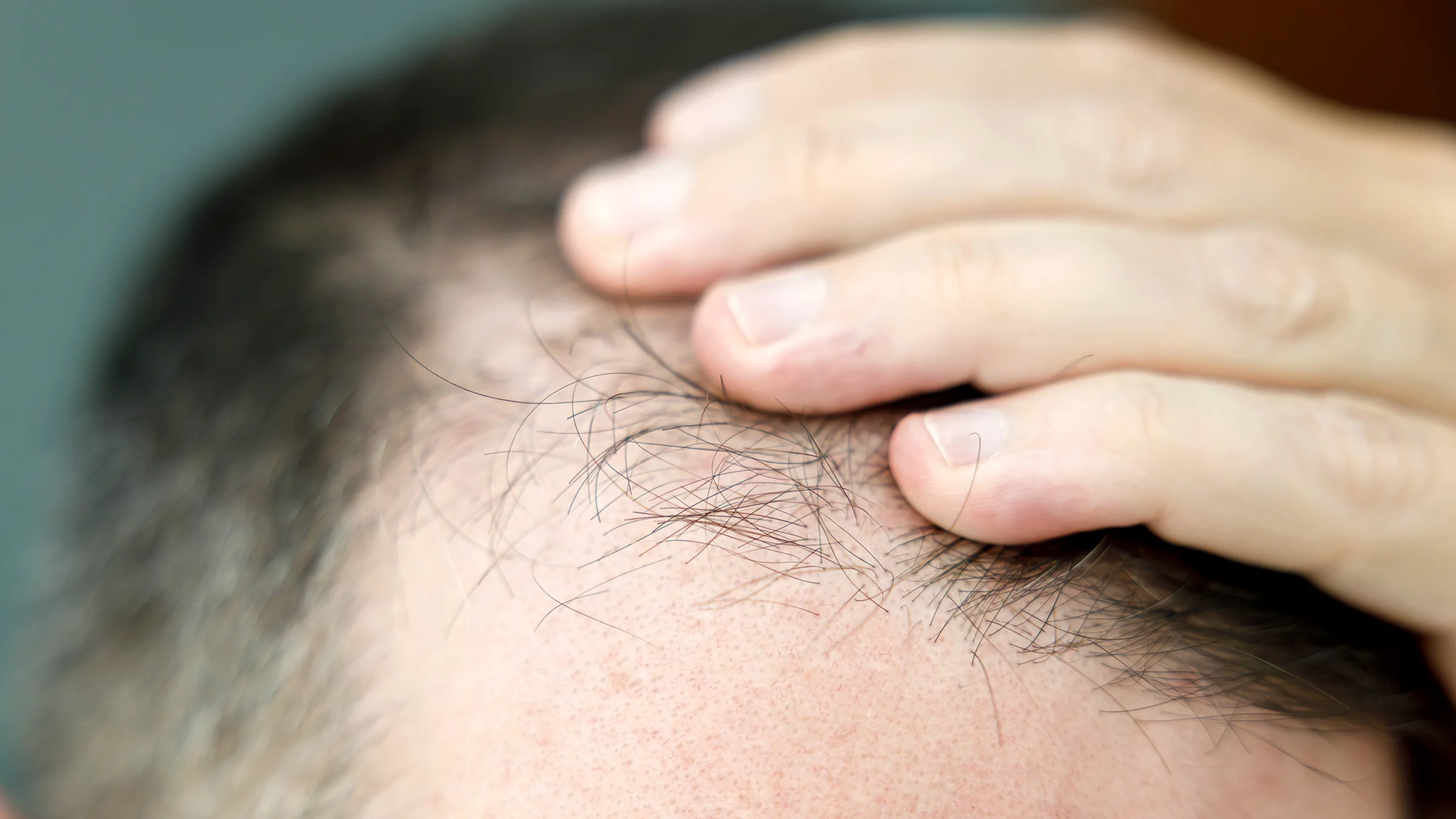 Close-up checking for hair loss