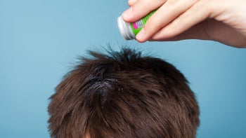 dermatology: closeup man applying powder to scalp 1185615018