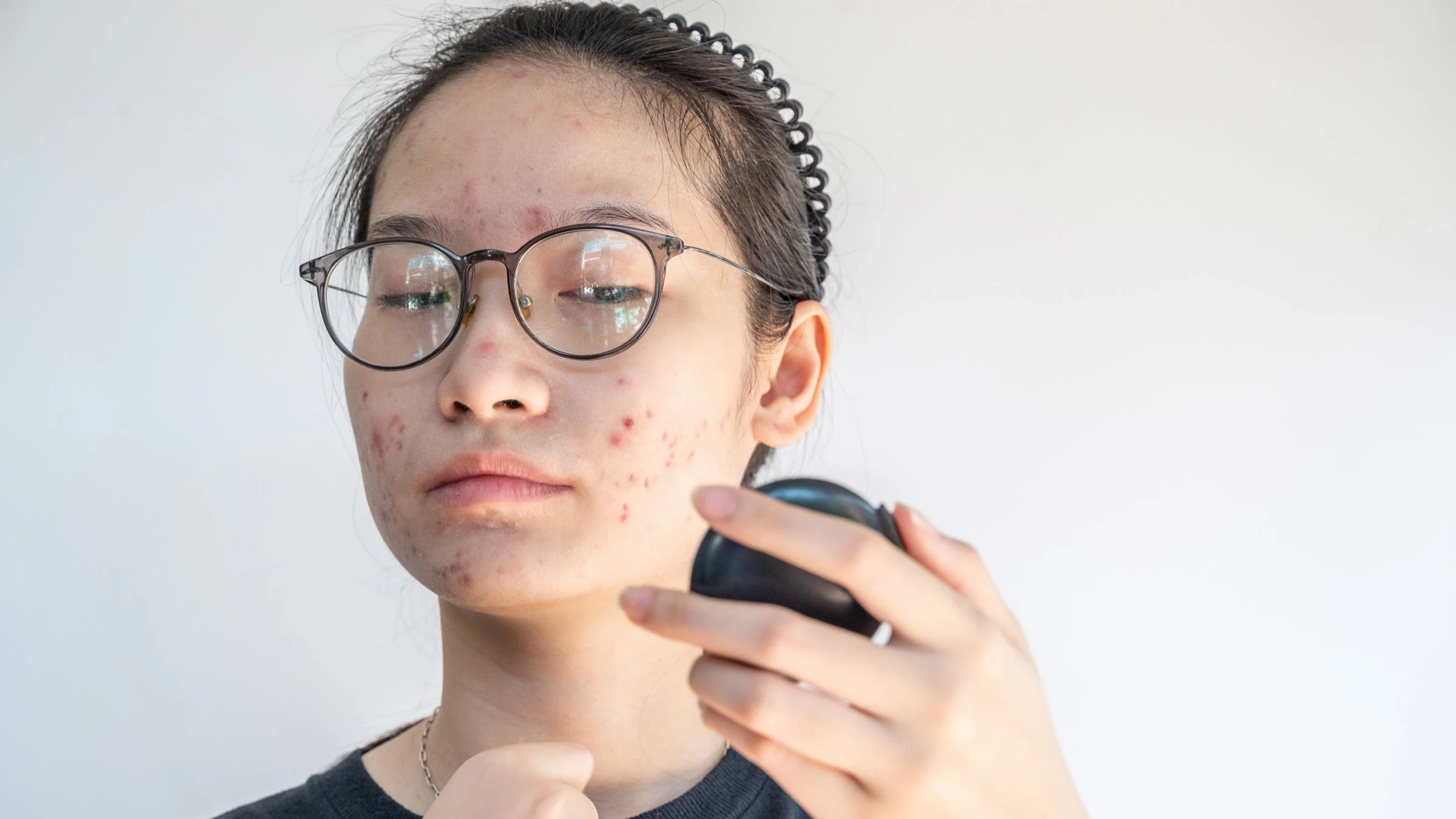 A person checking their acne in a handheld mirror.