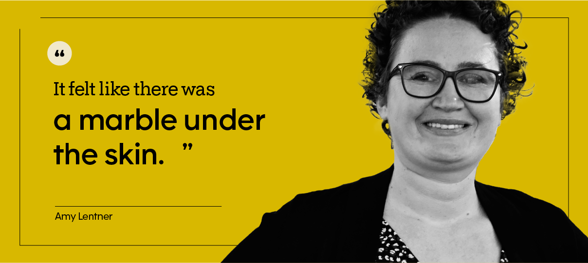 “It felt like there was a marble under the skin.” — Amy Lentner