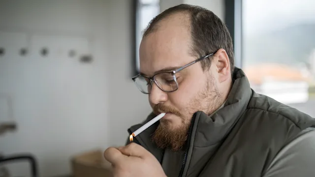 Hair-loss: man lighting cigarette 2057979079