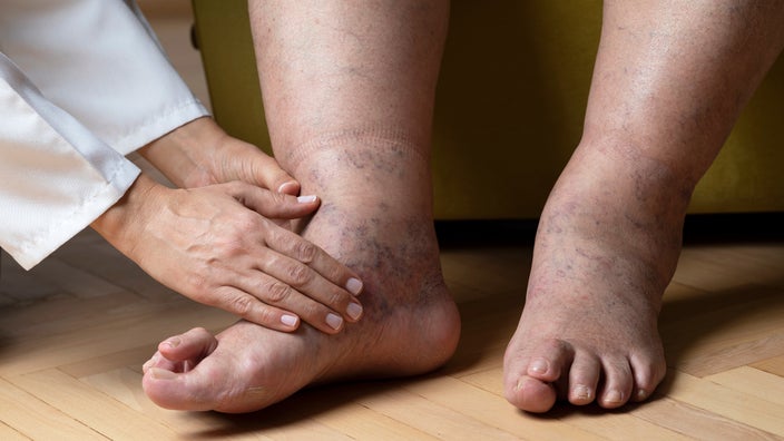 A foot specialist is examining a person’s feet in a close-up.