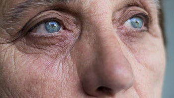 Macular degeneration: closeup womans eyes 1079961158