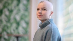 Olumiant (baricitinib) is now the first approved systemic treatment for alopecia areata. Here’s how it works and how it compares to other alopecia treatments.