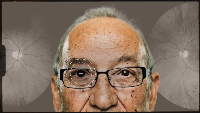 eye: surgery cataract weis-01