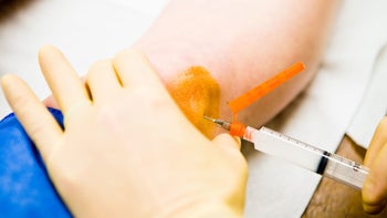 Arthritis: Injections: knee needle injection GettyImages 157526960