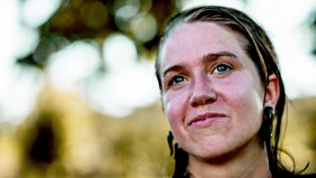 Dermatology: portrait red face 1413678461