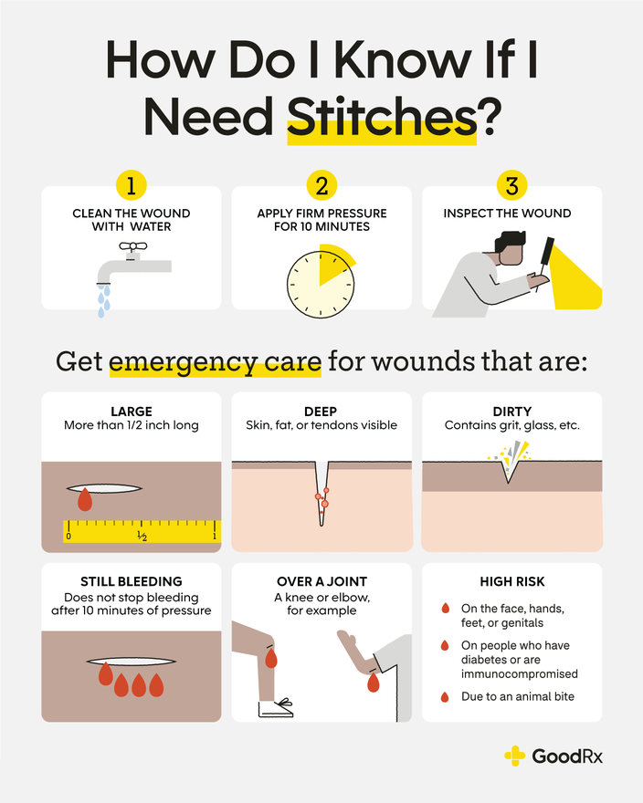 How to Safely Stop a Cut From Bleeding - GoodRx