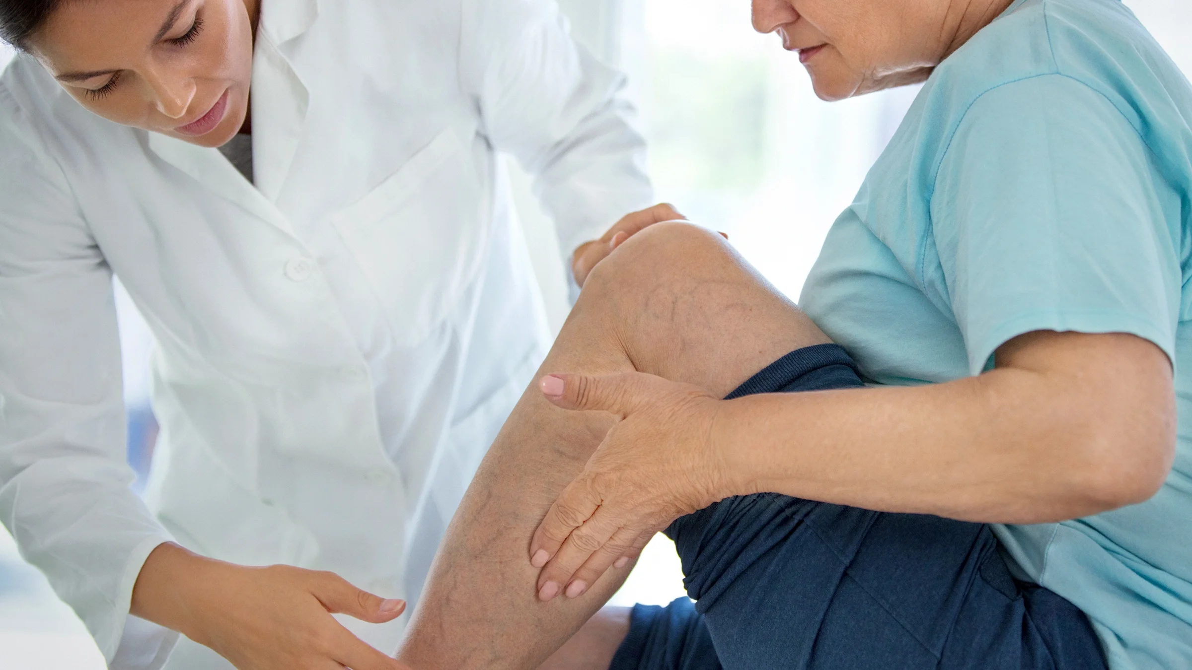 A medical professional examines the leg of a woman with visible varicose veins.