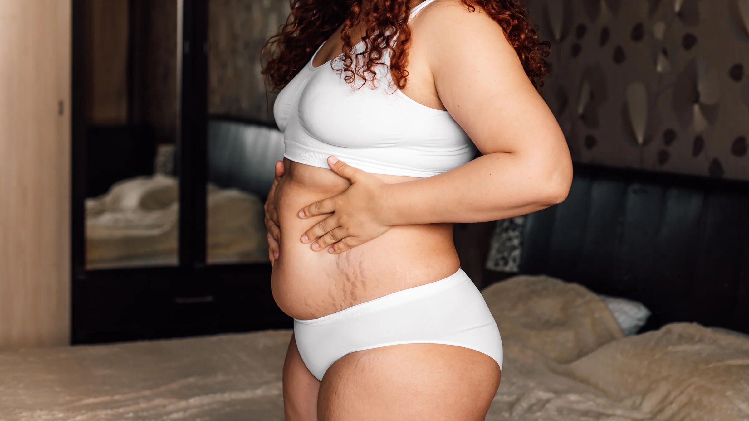 A woman with stretch marks touches her belly.