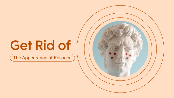 how to get rid of rosacea bumps on face