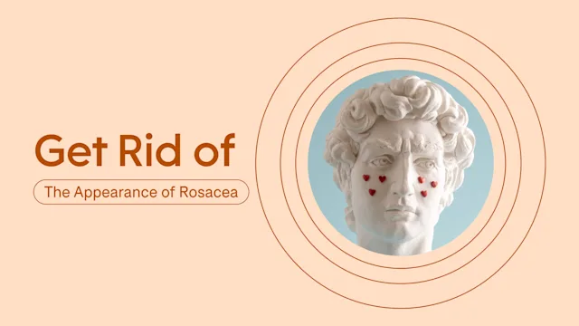 Health: Patient experiences: Rosacea rid featured image 2400