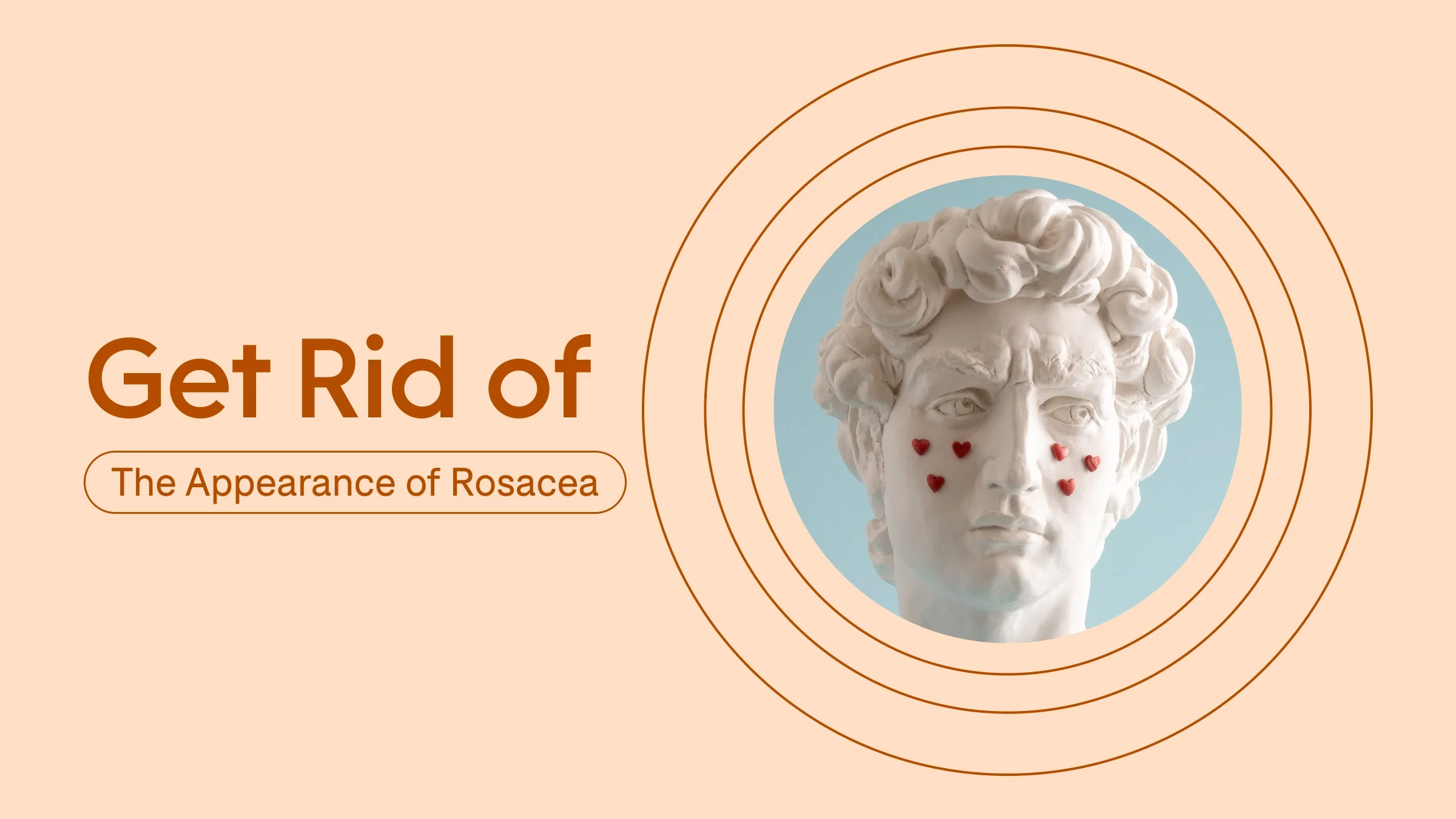 Custom graphic reading “Get Rid of the Appearance of Rosacea.” On the right is a circular cropped image of an Italian statue with red hearts on its cheeks surrounded by red circles.