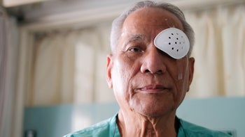 eye: vision: cataracts: senior man post eye surgery-1212623647