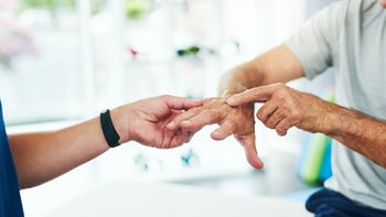 Simponi: closeup arthritis patient 1135098706