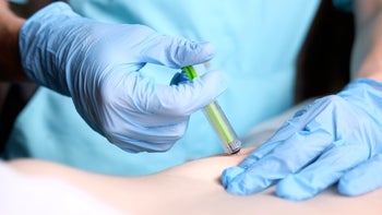 Osteoporosis: closeup injection 995386420