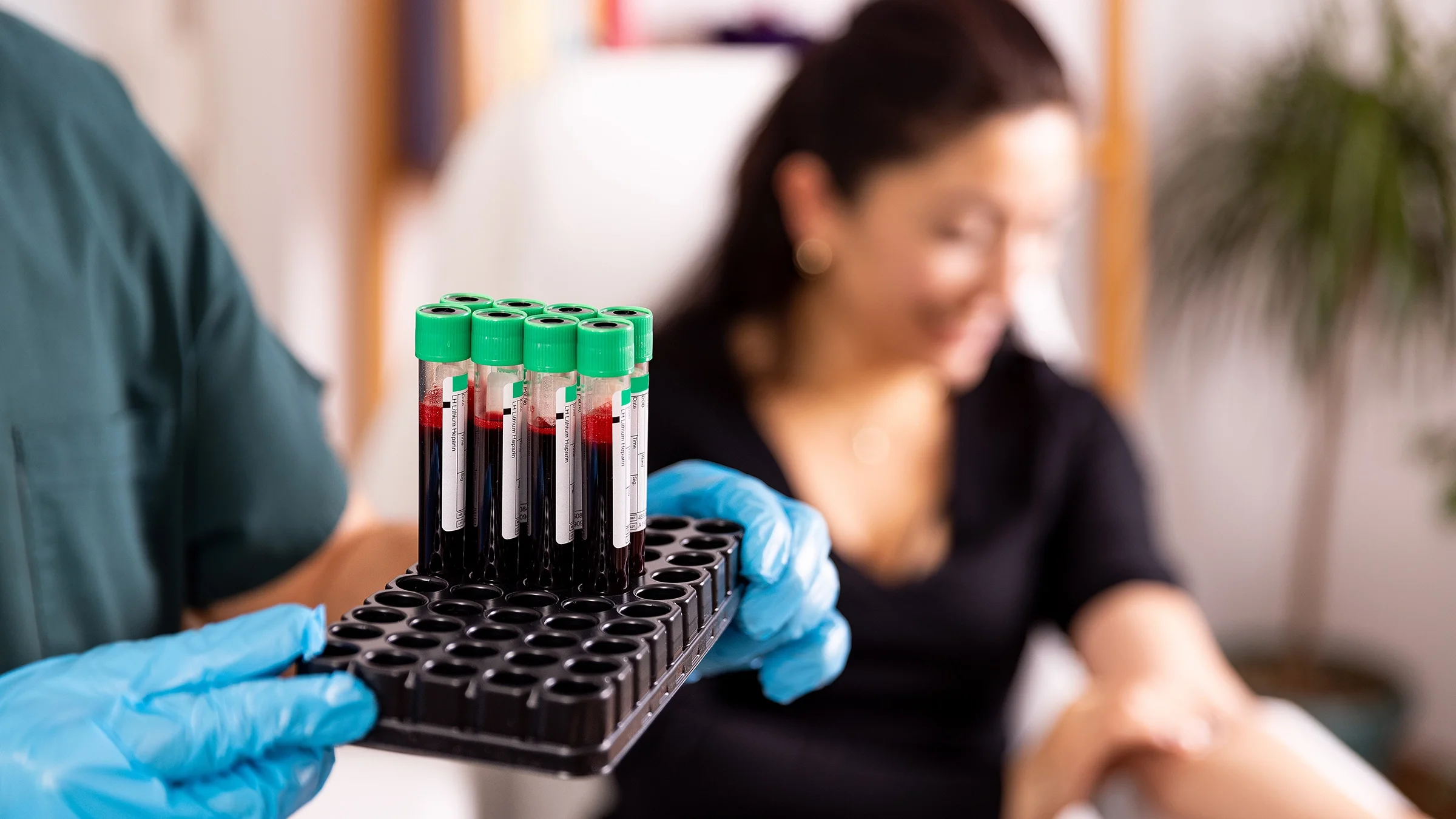 A healthcare provider carrying vials filled with blood. You can test your blood for chloride levels, which can tell you the fluid balance in your body.