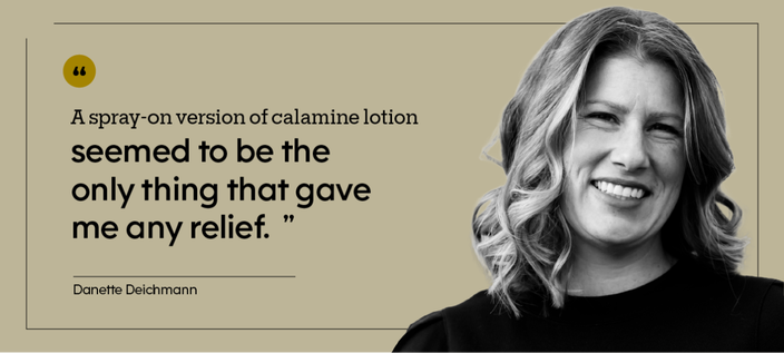 “A spray-on version of calamine lotion seemed to be the only thing that gave me any relief.” — Danette Deichmann